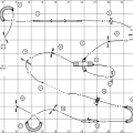 1A Agi