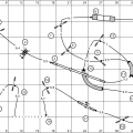 3B Agi